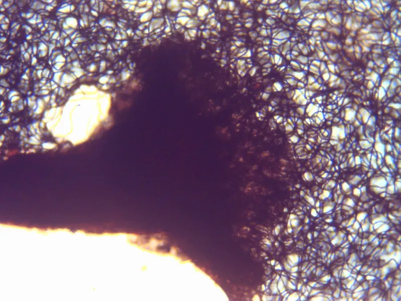 Arcyria denudata 12 - pie x 100